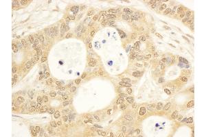 Immunohistochemistry (IHC) image for anti-Cytokine Induced Apoptosis Inhibitor 1 (CIAPIN1) (AA 100-150) antibody (ABIN7454468)