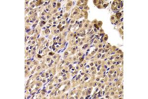 Immunohistochemistry of paraffin-embedded Rat stomach using CCT4 antibody at dilution of 1:100 (x400 lens). (CCT4 Antikörper)