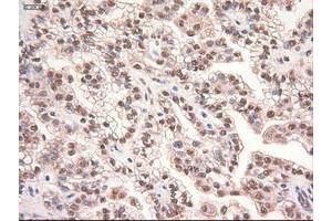 Image no. 9 for anti-Myc Proto-Oncogene protein (MYC) antibody (ABIN1497013) (c-MYC Antikörper)
