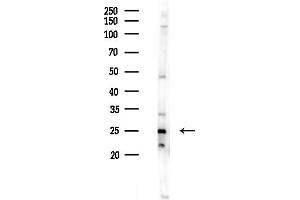 anti-COMM Domain Containing 5 (COMMD5) (N-Term) antibody