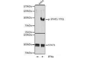 Western blot analysis of extracts of HeLa cells using Phospho-STAT1(Y701) Polyclonal Antibody at dilution of 1:1000. (STAT1 Antikörper  (pTyr701))