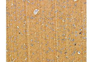 ABIN7095870 and ABIN7099932 at 1/100 staining rat brain tissue by IHC-P. (PARP16 Antikörper)