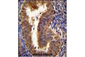 NIX Antibody (Center) (ABIN655731 and ABIN2845178) immunohistochemistry analysis in formalin fixed and paraffin embedded human uterus tissue followed by peroxidase conjugation of the secondary antibody and DAB staining. (BNIP3L/NIX Antikörper  (AA 52-81))