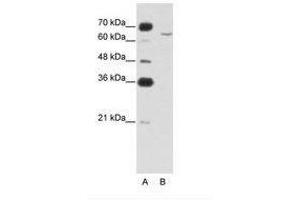 Image no. 1 for anti-Cytoplasmic Polyadenylation Element Binding Protein 2 (CPEB2) (AA 543-592) antibody (ABIN6749718) (CPEB2 Antikörper  (AA 543-592))