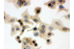 Immunohistochemistry (IHC) image for anti-Solute Carrier Family 2 (Facilitated Glucose Transporter), Member 1 (SLC2A1) (AA 92-492) antibody (ABIN3043927)
