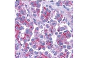 Smac/DIABLO â€“ ABIN121595 staining of human ovary tissue with anti-Smac/DIABLO (CT) at 5 (DIABLO Antikörper  (AA 225-239))
