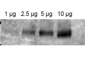 Image no. 1 for anti-ATP-Binding Cassette, Sub-Family B (MDR/TAP), Member 1 (ABCB1) (AA 262-277) antibody (ABIN401371) (ABCB1 Antikörper  (AA 262-277))