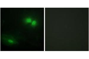 Immunofluorescence analysis of HeLa cells, using DAXX Antibody. (DAXX Antikörper  (AA 361-410))