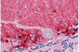Human Brain, Cerebellum (formalin-fixed, paraffin-embedded) stained with AMPH antibody ABIN351482 at 2. (Amphiphysin Antikörper  (AA 159-170))