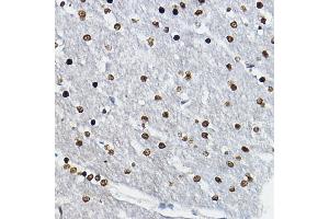 Immunohistochemistry of paraffin-embedded rat brain using SOX10 Rabbit pAb (ABIN6134484, ABIN6148289 and ABIN7101829) at dilution of 1:100 (40x lens). (SOX10 Antikörper)