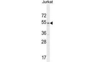 Western blot analysis in Jurkat cell line lysates (35ug/lane) using MPP1 Antibody . (MPP1 Antikörper  (Middle Region))
