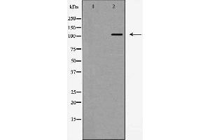 Western blot analysis of EPHA4 expression in JurKat cells. (EPH Receptor A4 Antikörper  (Internal Region))