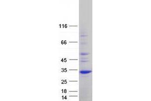 Western Blotting (WB) image for Unc-119 Homolog (UNC119) (Transcript Variant 2) protein (Myc-DYKDDDDK Tag) (ABIN2735012)