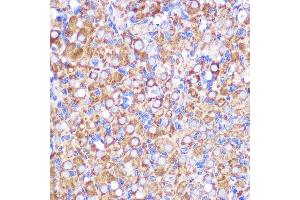 Immunohistochemistry of paraffin-embedded Rat ovary using NEK9 antibody (ABIN7268914) at dilution of 1:100 (40x lens). (NEK9 Antikörper  (AA 730-979))