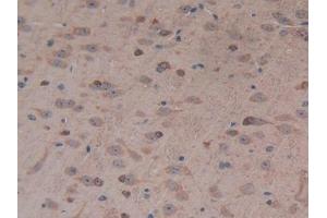 Immunohistochemistry (IHC) image for anti-Urocortin 2 (UCN2) (AA 31-112) antibody (ABIN7435025)
