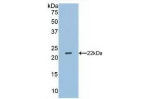 Detection of Recombinant DUSP3, Human using Polyclonal Antibody to Dual Specificity Phosphatase 3 (DUSP3) (Dual Specificity Phosphatase 3 (DUSP3) (AA 2-185) Antikörper)