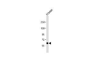 Anti-SLC2A13 Antibody (Center) at 1:1000 dilution + human brain lysate Lysates/proteins at 20 μg per lane. (SLC2A13 Antikörper  (AA 268-297))