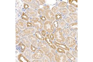 Immunohistochemistry of paraffin-embedded mouse kidney using KRAS Rabbit pAb (ABIN3021676, ABIN3021677, ABIN3021678, ABIN1513137 and ABIN1514282) at dilution of 1:150 (40x lens). (K-RAS Antikörper)