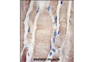 Formalin-fixed and paraffin-embedded human skeletal muscle tissue reacted with PHPT1 Antibody (N-term) (ABIN389182 and ABIN2839345) , which was peroxidase-conjugated to the secondary antibody, followed by DAB staining. (PHPT1 Antikörper  (C-Term))