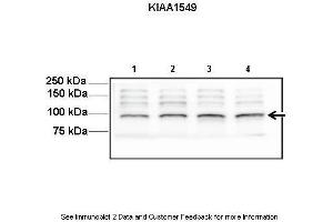 Lanes:   Lane1-4: 30ug mouse neurosphere lysate  Primary Antibody Dilution:   1:1000  Secondary Antibody:   Anti-rabbit HRP  Secondary Antibody Dilution:   1:5000  Gene Name:   KIAA1549  Submitted by:   Yi-Hsien Chen, Washington University School of Medicine