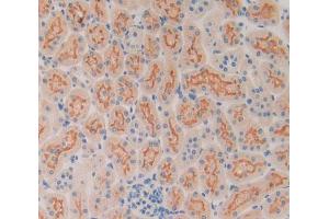 IHC-P analysis of kidney tissue, with DAB staining. (SP100 Antikörper  (AA 116-333))