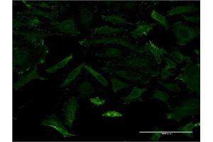 Immunofluorescence of monoclonal antibody to MAGI1 on HeLa cell. (MAGI1 Antikörper  (AA 761-859))