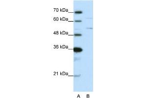 WB Suggested Anti-HNRPK Antibody Titration:  0. (HNRNPK Antikörper  (N-Term))