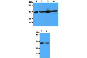 Western blot analysis The Recombinant Human Annexin A1 (10ng) and Cell lysates (40ug) were resolved by SDS-PAGE, transferred to PVDF membrane and probed with anti-human Annexin A1 antibody (1:3000). (BCL2A1 Antikörper)