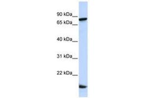 Image no. 1 for anti-Zinc Finger Protein 281 (ZNF281) (C-Term) antibody (ABIN6740570) (ZNF281 Antikörper  (C-Term))