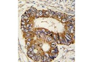 Immunohistochemistry (Paraffin-embedded Sections) (IHC (p)) image for anti-Prohibitin 2 (PHB2) (Tyr128) antibody (ABIN359503)