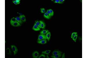 Immunofluorescence staining of HepG2 cells with ABIN7158130 at 1:133, counter-stained with DAPI. (LGR5 Antikörper  (AA 241-352))