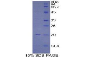 SDS-PAGE (SDS) image for Baculoviral IAP Repeat-Containing 5 (BIRC5) (AA 1-142) protein (His tag) (ABIN1099491) (Survivin Protein (AA 1-142) (His tag))