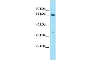 Western Blotting (WB) image for anti-Luteinizing Hormone/Choriogonadotropin Receptor (LHCGR) (C-Term) antibody (ABIN2788657) (LHCGR Antikörper  (C-Term))