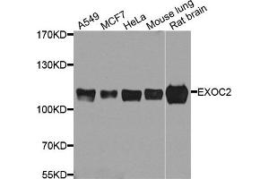 Western blot analysis of extract of various cells, using EXOC2 antibody. (EXOC2 Antikörper)