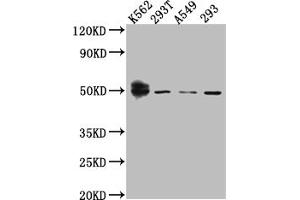 Western Blotting (WB) image for anti-Wilms Tumor 1 (WT1) antibody (ABIN7127870)