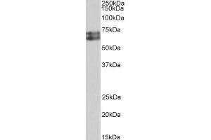 ABIN5539539 (0. (HDC Antikörper  (AA 449-462))