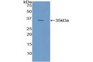 Detection of Recombinant FCN1, Mouse using Polyclonal Antibody to Ficolin 1 (FCN1) (FCN1 Antikörper  (AA 25-317))