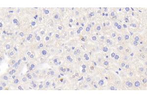 Detection of LOXL2 in Mouse Liver Tissue using Polyclonal Antibody to Lysyl Oxidase Like Protein 2 (LOXL2) (LOXL2 Antikörper  (AA 53-160))