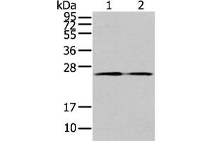 Gel: 12 % SDS-PAGE, Lysate: 40 μg, Lane 1-2: PC3 cell and human colon cancer tissue, Primary antibody: ABIN7192958(TUSC1 Antibody) at dilution 1/200 dilution, Secondary antibody: Goat anti rabbit IgG at 1/8000 dilution, Exposure time: 1 minute (TUSC1 Antikörper)