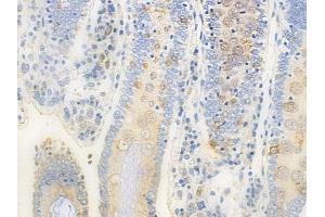 ABIN6258278 and ABIN6273860 at 1/100 staining human normal colon tissue by IHC-P. (GPR20 Antikörper  (C-Term))