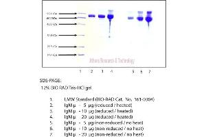 Gel Scan of Immunoglobulin M, mu Chain, Human Plasma  This information is representative of the product ART prepares, but is not lot specific. (IgM Protein)