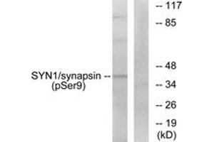 Western blot analysis of extracts from 293 cells treated with PMA 200nM 30', using Synapsin (Phospho-Ser9) Antibody. (SYN1 Antikörper  (pSer9))
