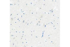 IHC analysis of FLIP/CFLAR using anti-FLIP/CFLAR antibody (ABIN5693075).