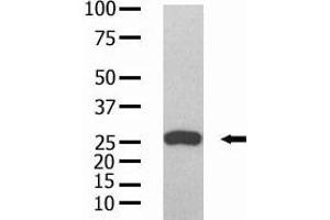 The anti-GST Mab (ABIN387751 and ABIN2843190) is used in Western blot to detect GST recombinant protein purified from bacterial lysate.