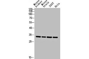 Western blot analysis of Mouse-kidney mouse-brain 293T hela lysis using CA II antibody. (CA2 Antikörper  (C-Term))