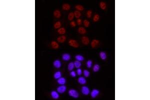 Immunofluorescence analysis of HeLa using Phospho-POLR2A CTD-S2 Rabbit mAb  at dilution of 1:100 (40x lens).