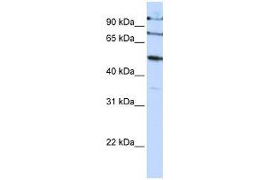 FBXO5 antibody used at 1 ug/ml to detect target protein. (FBXO5 Antikörper  (C-Term))