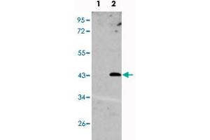 Western blot analysis of UNQ1887 (arrow) using UNQ1887 polyclonal antibody . (UNQ1887 (N-Term) Antikörper)