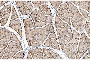 IHC analysis of CACNA1S using anti-CACNA1S antibody (ABIN7600160).