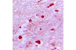 Immunohistochemical analysis of E2F2 staining in human brain formalin fixed paraffin embedded tissue section. (E2F2 Antikörper  (Center))